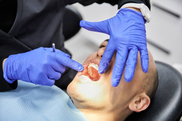 Best Urgent Care for Lost Fillings or Crowns in Woodlawn, VA